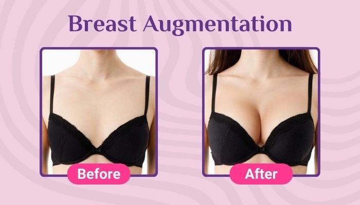 Get Expert Cosmetic Breast Surgery Clinic In Hyderabad Safe Effective